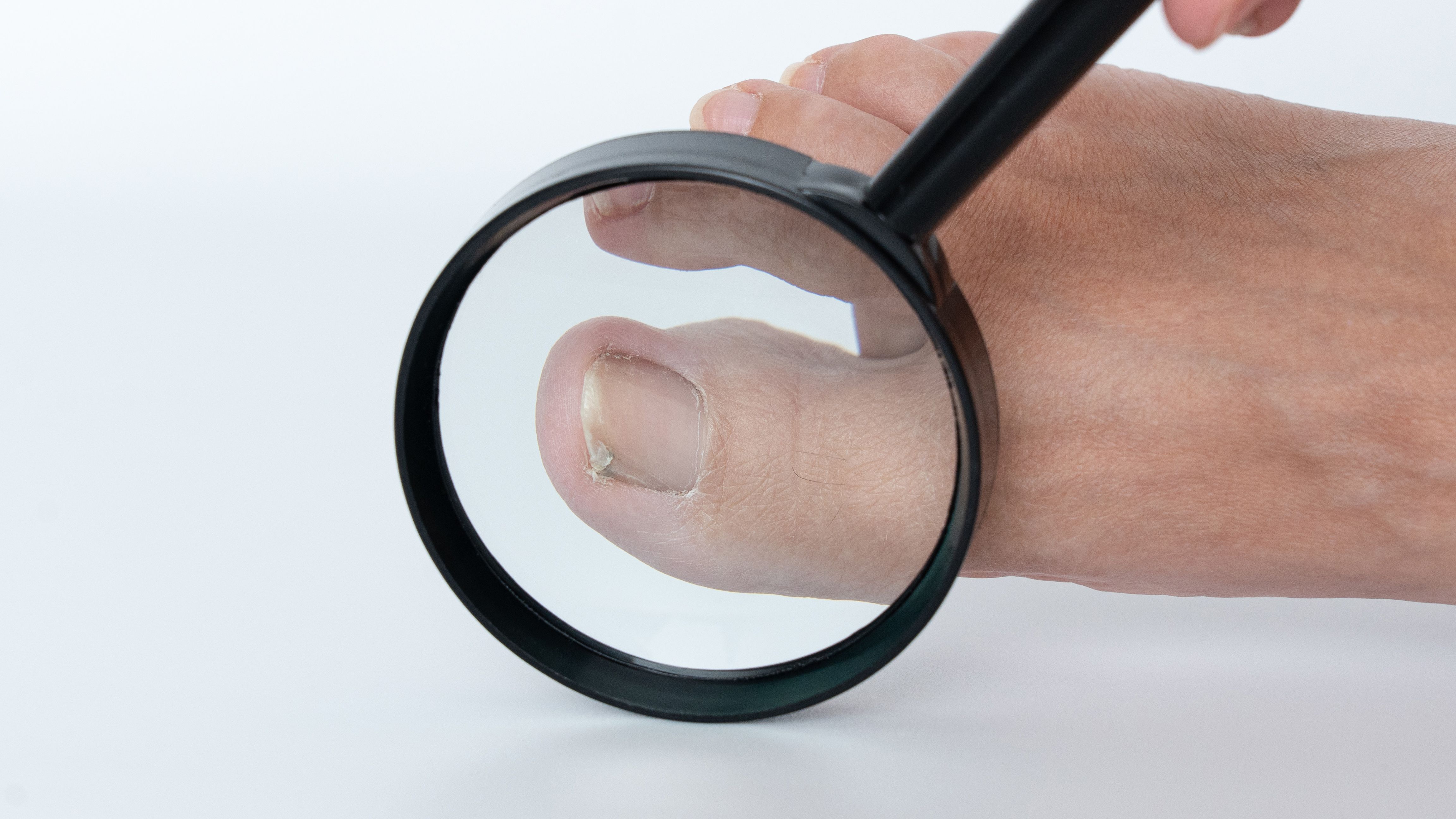 Close-up of a toenail being examined with a magnifying glass